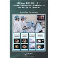 Visual Tracking in Conventional Minimally Invasive Surgery