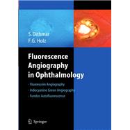 Fluorescence Angiography in Ophthalmology