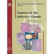 Tumors of the Salivary Glands