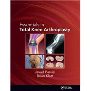 Essentials in Total Knee Arthroplasty