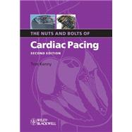 The Nuts and Bolts of Cardiac Pacing