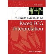 The Nuts and bolts of Paced ECG Interpretation