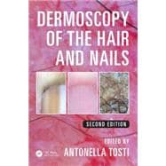 Dermoscopy of the Hair and Nails, Second Edition