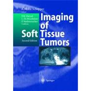 Imaging of Soft Tissue Tumors