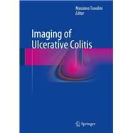 Imaging of Ulcerative Colitis
