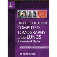High Resolution Computed Tomography of the Lungs