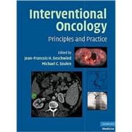 Interventional Oncology: Principles and Practice
