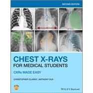 Chest X-Rays for Medical Students CXRs Made Easy