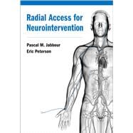 Radial Access for Neurointervention