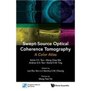 Swept-source Optical Coherence Tomography