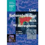 Liver Radioembolization With 90Y Microspheres