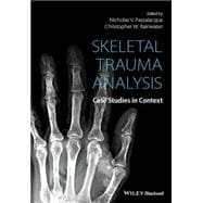 Skeletal Trauma Analysis Case Studies in Context