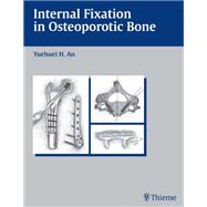 Internal Fixation in Osteoporotic Bone