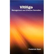 Vitiligo: Management and Effective Remedies