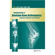 Fundamentals of Revision Knee Arthroplasty