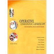 Operative Gynecologic Laparoscopy : Principles and Techniques