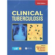 Clinical Tuberculosis, Fifth Edition