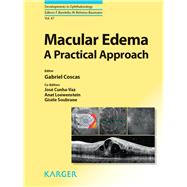 Macular Edema: A Practical Approach