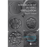Handbook of in Vitro Fertilization