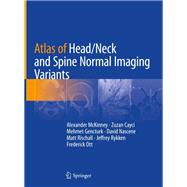 Atlas of Head/Neck and Spine Normal Imaging Variants