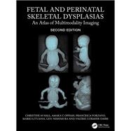 Fetal and Perinatal Skeletal Dysplasias
