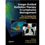 Image-guided Radiation Therapy in Lymphoma Management