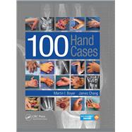 100 Hand Cases