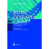 Bone Diseases: Macroscopic, Histological, and Radiological Diagnosis of Structural Changes in the Skeleton