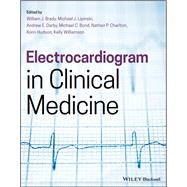 Electrocardiogram in Clinical Medicine