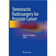 Stereotactic Radiosurgery for Prostate Cancer