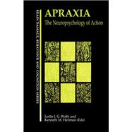 Apraxia