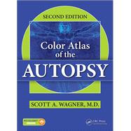 Color Atlas of the Autopsy, Second Edition