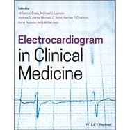 Electrocardiogram in Clinical Medicine
