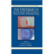 The Epidermis in Wound Healing