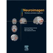 Neuroimagen. Técnicas y procesos cognitivos