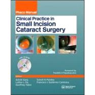 Clinical Practice in Small Incision Cataract Surgery : (Phaco Manual)