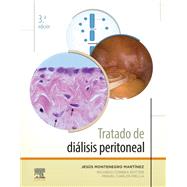 Tratado de diálisis peritoneal