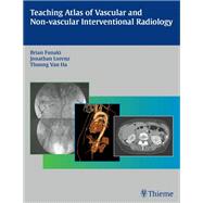 Teaching Atlas of Vascular and Non-vascular Interventional Radiology,9781604064728