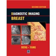 Diagnostic Imaging: Breast, 2nd ed Published by Amirsys