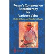 Fegan’s Compression Sclerotherapy for Varicose Veins