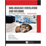 Non-Invasive Ventilation and Weaning: Principles and Practice, Second Edition