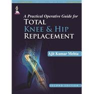 A Practical Operative Guide for Total Knee and Hip Replacement