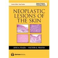 Neoplastic Lesions of the Skin
