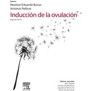 Inducción de la ovulación