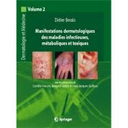 Dermatologie Et Maladies Infectieuses, Metaboliques Et Toxiques