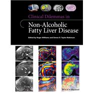 Clinical Dilemmas in Non-Alcoholic Fatty Liver Disease