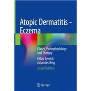 Atopic Dermatitis - Eczema