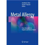 Metal Allergy