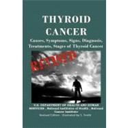 Thyroid Cancer : Causes, Symptoms, Signs, Diagnosis, Treatments, Stages of Thyroid Cancer