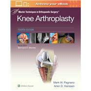 Master Techniques in Orthopedic Surgery: Knee Arthroplasty